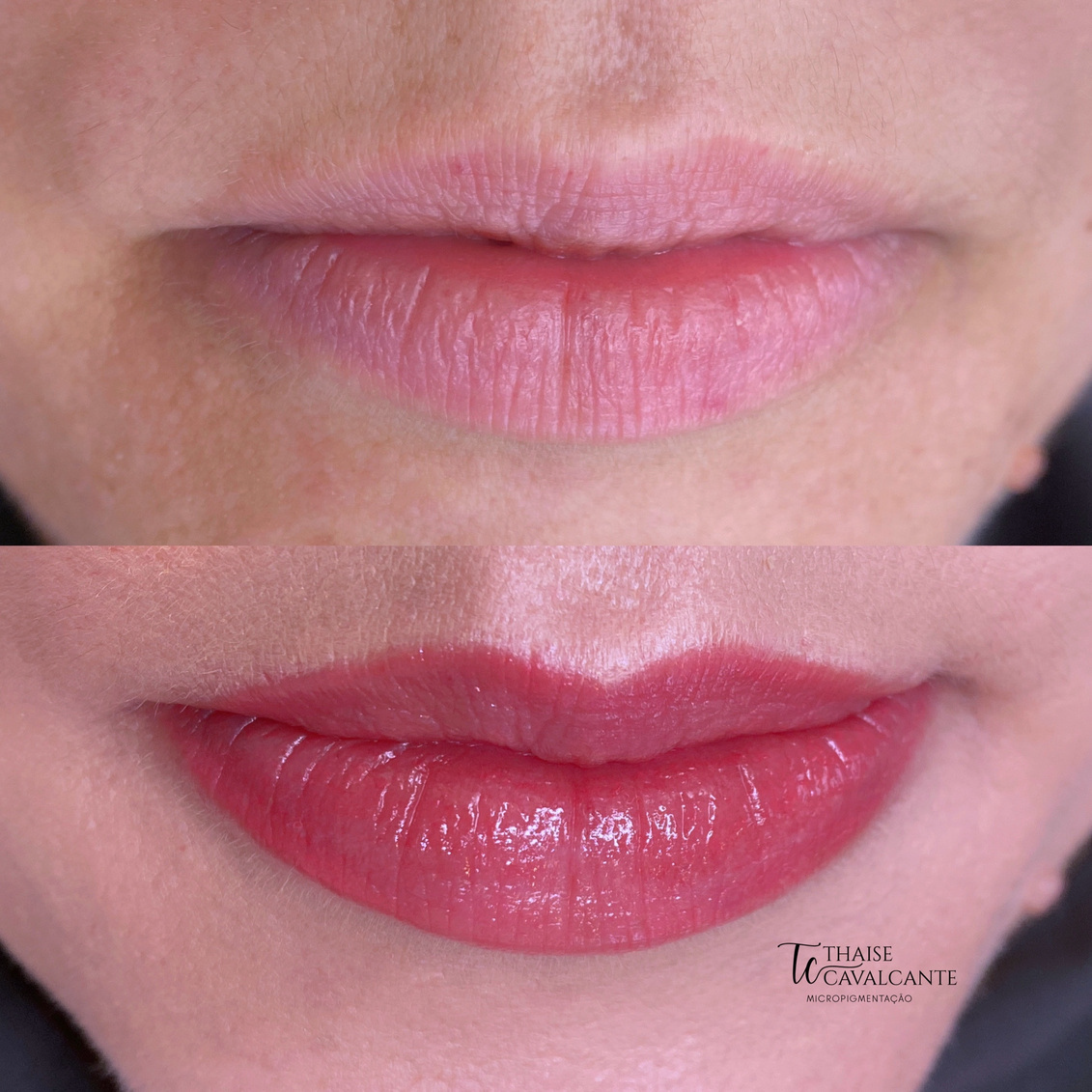 Suavizze Lips